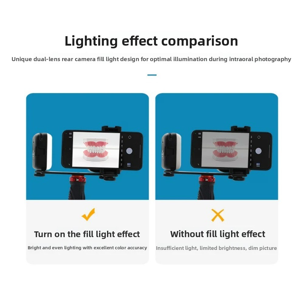 치과 사진 촬영 조명, 스마트폰용 블루투스 LED 플래 - Photography Lighting Kit Portable 리뷰 및 가격